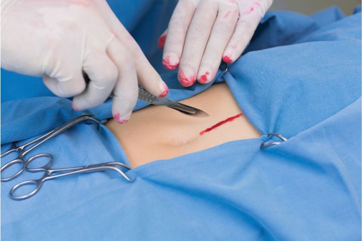 Performing Incisions or making cuts for surgical access mpp